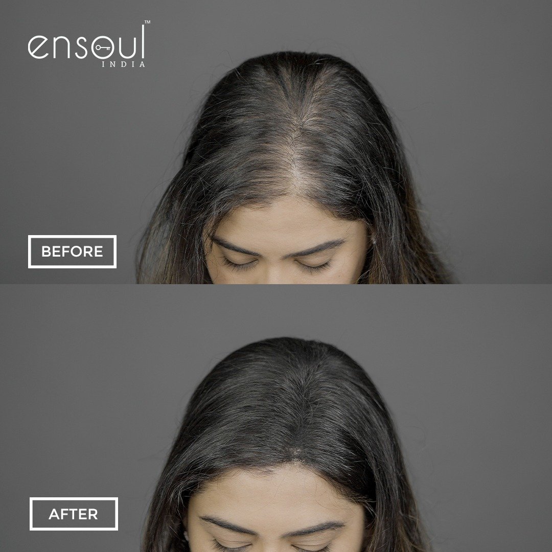 ENSOUL Hair Building Fibers, 18gms - Ensoul India | Hair Building Fibers  Online in India | Hair Growth Products