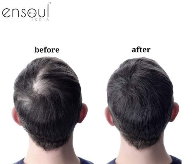 Ensoul Hair Fibers